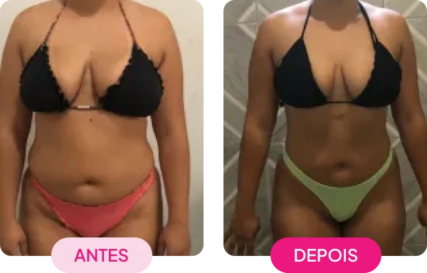 img-antes-depois1