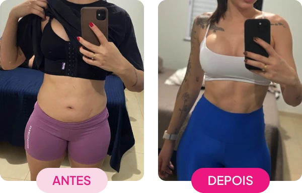 img-antes-depois2