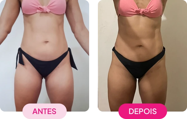 img-antes-depois3