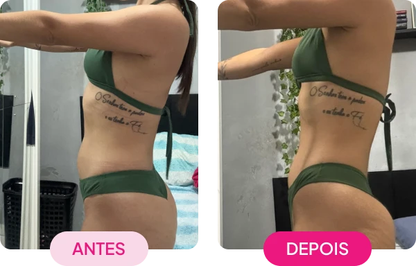 img-antes-depois4